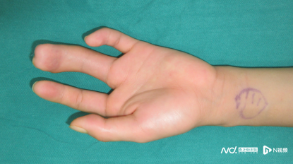 imagefile 415x232_6878e9249698c.png?X-Amz-Content-